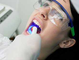 Dental Restorations